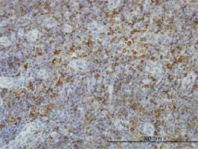 Immunohistochemistry-Paraffin: HLA DPB1 Antibody (6C6) [H00003115-M01]