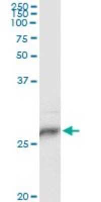 Immunoprecipitation: HLA DPB1 Antibody (6C6) [H00003115-M01]