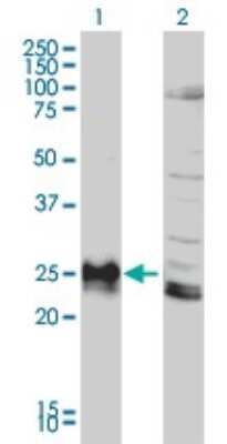 Western Blot: HLA DPB1 Antibody (6C6) [H00003115-M01]