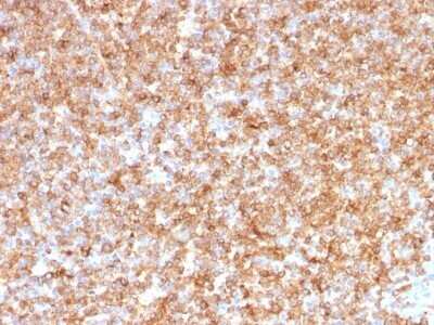 Immunohistochemistry-Paraffin: HLA DQ/DR/DP Antibody (CR3/43) - Azide and BSA Free [NBP2-54507]