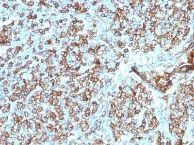 Immunohistochemistry-Paraffin: HLA DQ/DR/DP Antibody (CR3/43) - Azide and BSA Free [NBP2-54507]