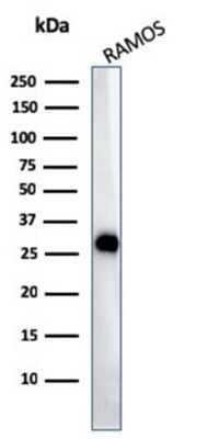 Western Blot: HLA DQ/DR/DP Antibody (CR3/43) [NBP2-53380]