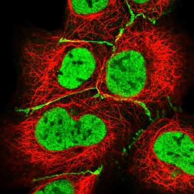 Immunocytochemistry/ Immunofluorescence: HLA DPB1 Antibody [NBP2-56722]