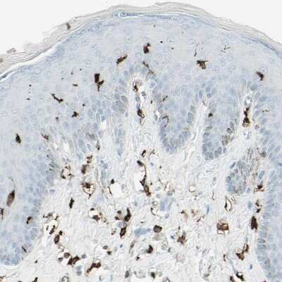 Immunohistochemistry-Paraffin: HLA DPB1 Antibody [NBP1-89688]
