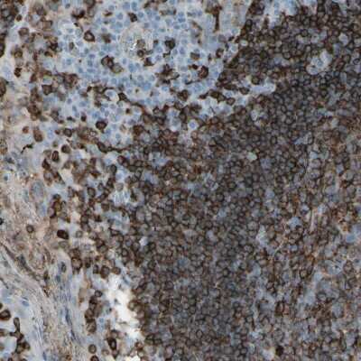 Immunohistochemistry-Paraffin: HLA DPB1 Antibody [NBP1-89688]