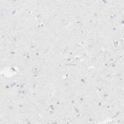 Immunohistochemistry-Paraffin: HLA DPB1 Antibody [NBP1-89688]