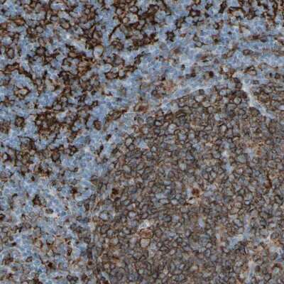 Immunohistochemistry-Paraffin: HLA DPB1 Antibody [NBP1-89688]