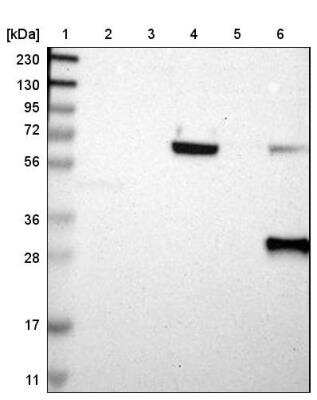 Western Blot: HLA DPB1 Antibody [NBP1-89688]