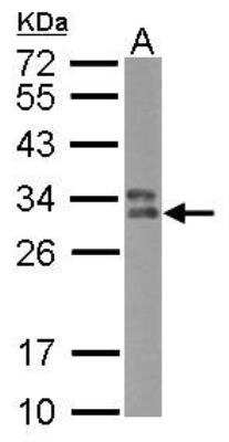 Western Blot: HLA DPB1 Antibody [NBP2-16852]