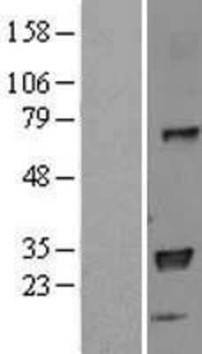 Western Blot: HLA DPB1 Overexpression Lysate [NBL1-11583]