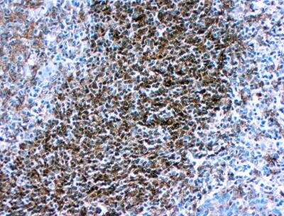 Immunohistochemistry-Paraffin: HLA DQ/DR/DP Antibody (CR3/43) [NB120-17101]
