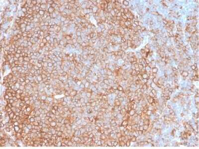 Immunohistochemistry-Paraffin: HLA DQ/DR/DP Antibody (HLA-Pan/2967R) - Azide and BSA Free [NBP2-79843]