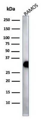 Western Blot: HLA DQ/DR/DP Antibody (HLA-Pan/2967R) [NBP2-79709]