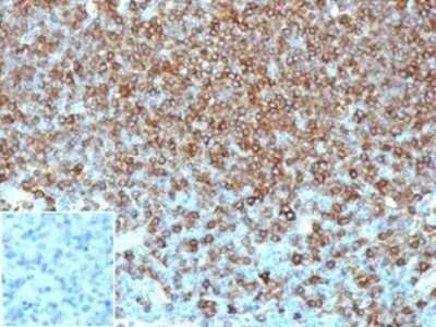 Immunohistochemistry-Paraffin: HLA DQ/DR/DP Antibody (HLA-Pan/6663) [NBP3-13905]