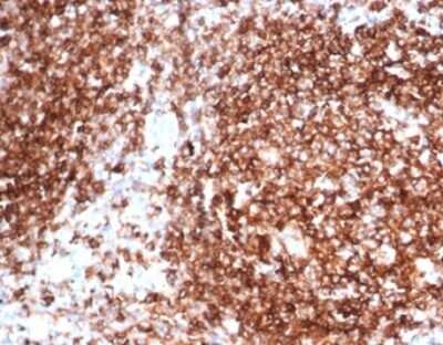 Immunohistochemistry-Paraffin: HLA DQ/DR/DP Antibody (HLA-Pan/6663) [NBP3-13905]