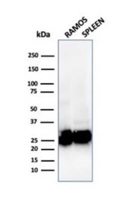 Western Blot: HLA DQ/DR/DP Antibody (rHLA-Pan/3475)Azide and BSA Free [NBP3-08644]