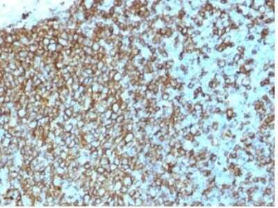 Immunohistochemistry-Paraffin: HLA DQ/DR/DP Antibody (rHLA-Pan/3475) [NBP3-07808]