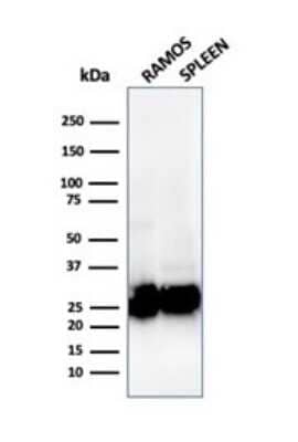 Western Blot: HLA DQ/DR/DP Antibody (rHLA-Pan/3475) [NBP3-07808]