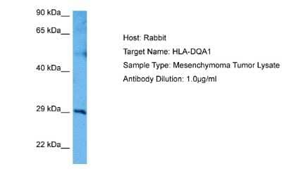 Western Blot: HLA DQ3 Antibody [NBP2-84068]