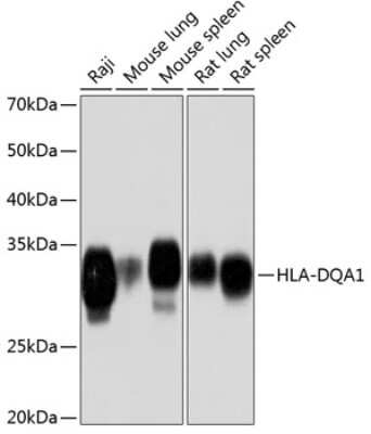 Western Blot: HLA DQA1 Antibody (7W0M7) [NBP3-15364]