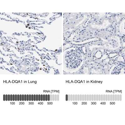 Immunohistochemistry-Paraffin: HLA DQA1 Antibody [NBP1-84550]