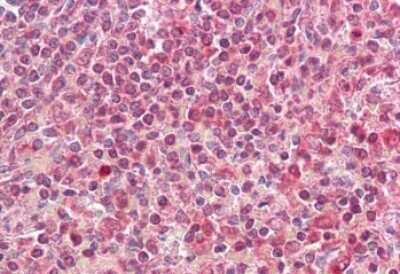 Immunohistochemistry-Paraffin: HLA DQA2 Antibody [NBP1-52186]