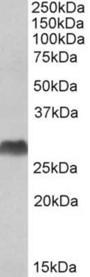 Western Blot: HLA DQA2 Antibody [NBP1-52094]