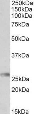 Western Blot: HLA DQA2 Antibody [NBP1-52186]