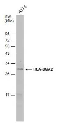 Western Blot: HLA DQA2 Antibody [NBP3-12911]