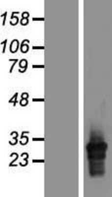 Western Blot: HLA DQA2 Overexpression Lysate [NBP2-06688]