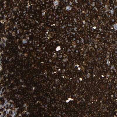 Immunohistochemistry-Paraffin: HLA DQB1 Antibody [NBP1-84549]