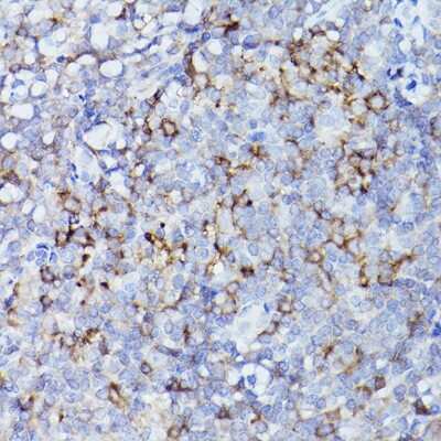 Immunohistochemistry-Paraffin: HLA DQB1 Antibody - Azide and BSA Free [NBP3-16006]