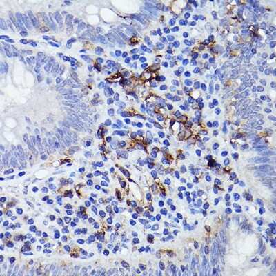 Immunohistochemistry-Paraffin: HLA DQB1 Antibody - Azide and BSA Free [NBP3-16006]