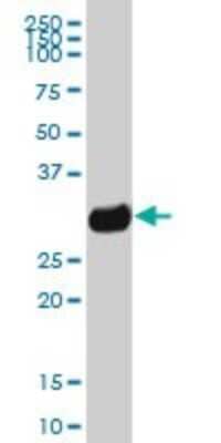 Western Blot: HLA DQB1 Antibody [H00003119-B01P]