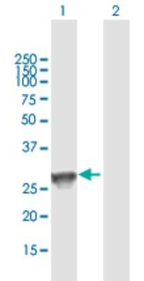 Western Blot: HLA DQB1 Antibody [H00003119-B01P]