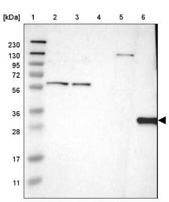 Western Blot: HLA DQB1 Antibody [NBP1-84549]