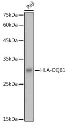 Western Blot: HLA DQB1 AntibodyAzide and BSA Free [NBP3-16006]