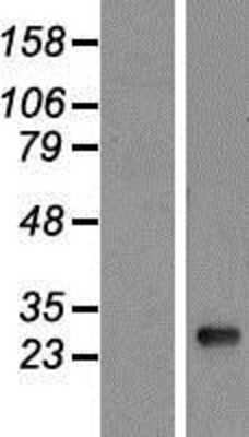 Western Blot: HLA DQB1 Overexpression Lysate [NBP2-10780]