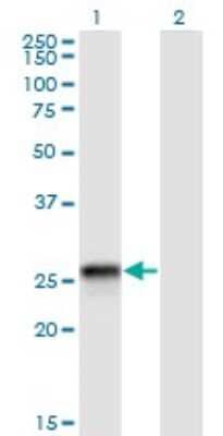 Western Blot: HLA DQB2 Antibody (4C3) [H00003120-M01]