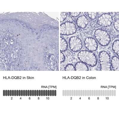 Immunocytochemistry/ Immunofluorescence: HLA DQB2 Antibody [NBP3-17054]