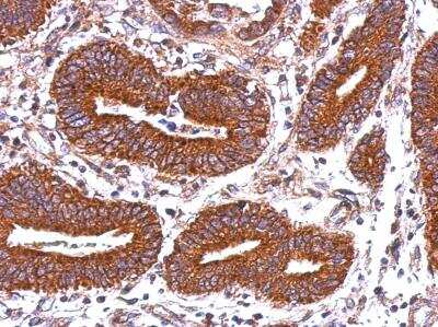 Immunohistochemistry-Paraffin: HLA DQB2 Antibody [NBP2-14984]