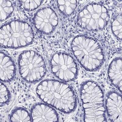 Immunohistochemistry-Paraffin: HLA DQB2 Antibody [NBP3-17054]