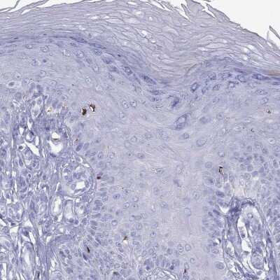 Immunohistochemistry-Paraffin: HLA DQB2 Antibody [NBP3-17054]