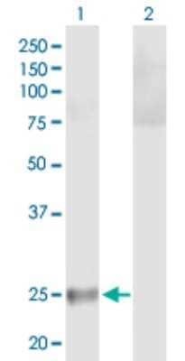 Western Blot: HLA DQB2 Antibody [H00003120-B01P]