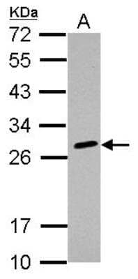 Western Blot: HLA DQB2 Antibody [NBP2-14984]