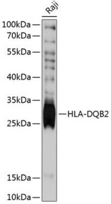 Western Blot: HLA DQB2 AntibodyAzide and BSA Free [NBP3-03636]