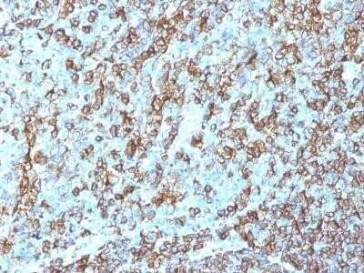 Immunohistochemistry-Paraffin: HLA-DR Antibody (LN-3) - Azide and BSA Free [NBP2-47670]