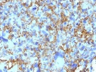 Immunohistochemistry-Paraffin: HLA-DR Antibody (LN-3) - IHC-Prediluted [NBP2-48112]