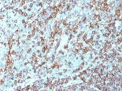 Immunohistochemistry-Paraffin: HLA-DR Antibody (LN-3) - IHC-Prediluted [NBP2-48112]