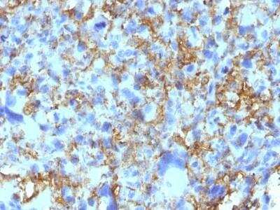 Immunohistochemistry-Paraffin: HLA-DR Antibody (LN-3) [NBP2-45310]